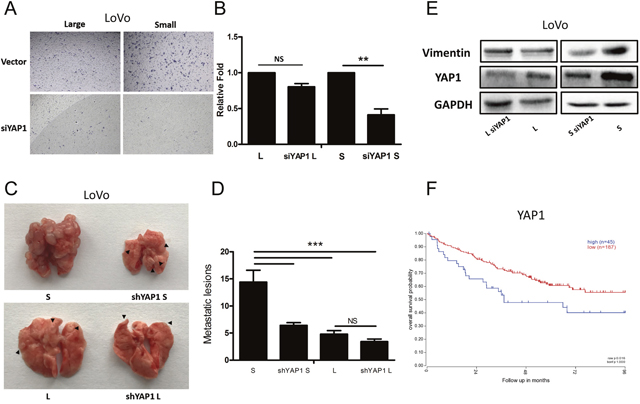 YAP1 regulates tumorigenicity and lung metastatic potential in small cells but not large CRC cells.