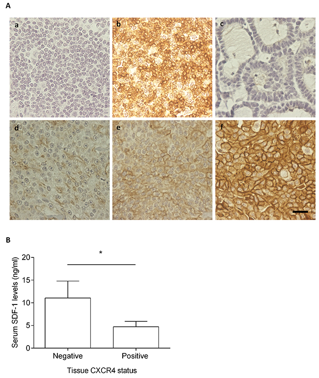 Cats with CXCR4-positive mammary carcinoma show low serum SDF-1 levels.