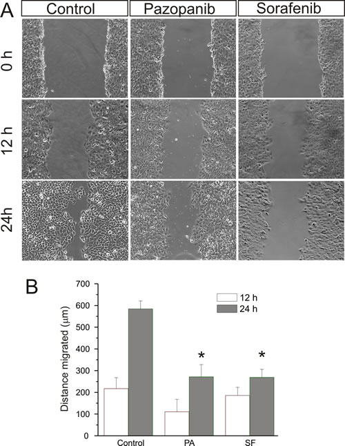 Fig 6: Pazopanib and Sorafenib inhibit medulloblastoma cell migration.