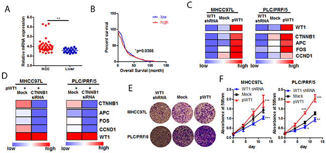 WT1-promoted HCC progression was associated with Wnt/&beta;-catenin pathway.