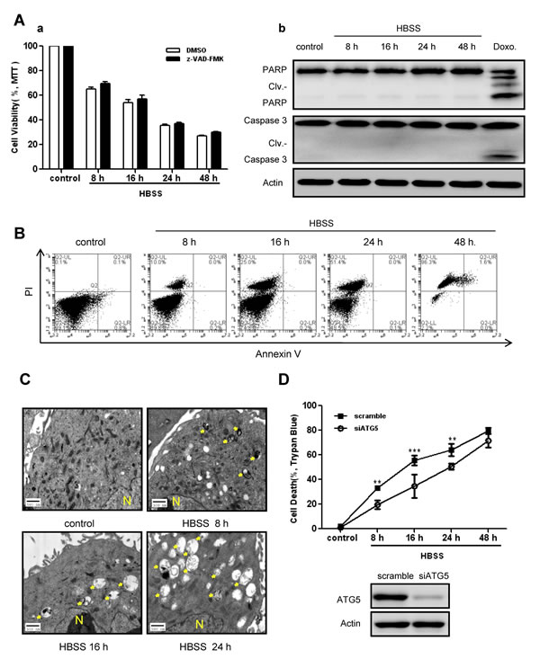 Autophagy acted as a death mechanism during persistent metabolic stress.