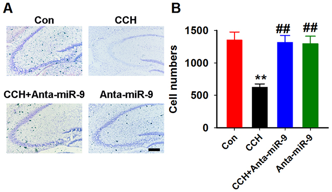 Inhibition of miR-9-5p restored the neuronal loss in CCH rats.