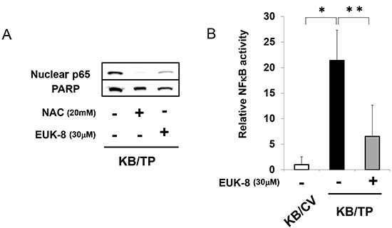 Suppression of TP-induced NF&#x03BA;B activity by antioxidants.
