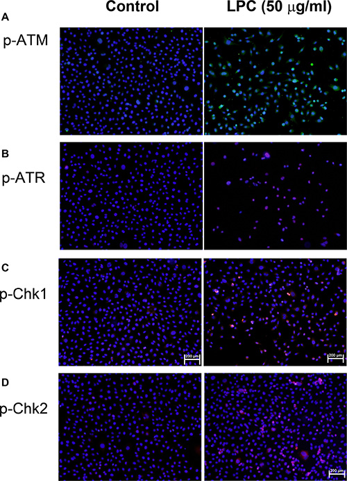 Induction of p-ATM, p-ATR, p-Chk1, and p-Chk2 expression by LPC to endothelial cells.
