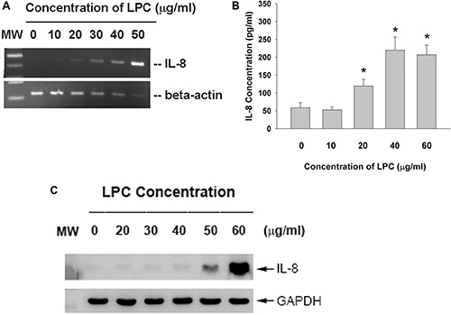 Effect of LPC on IL-8 expression and production.