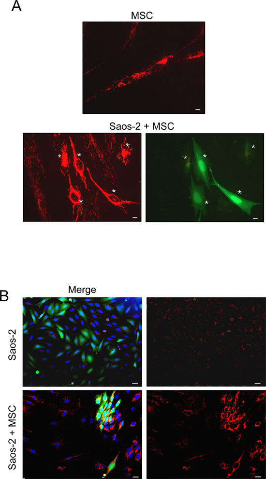 MSC-Saos-2 cell co-cultures exhibit changes in the mitochondrial state