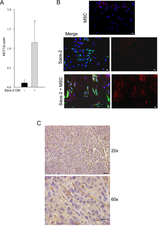 Tumor-activated MSC induce high MCT-1 expression in Saos-2 cells.