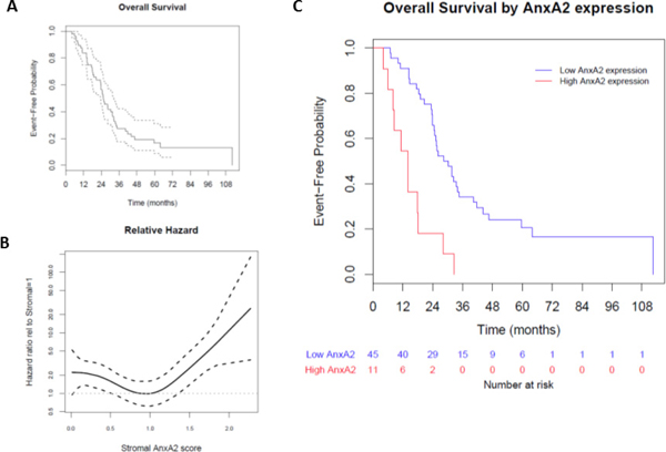 Effect of stromal AnxA2 score on overall survival.