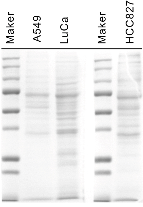 One-dimensional SDS PAGE of conditioned medium.