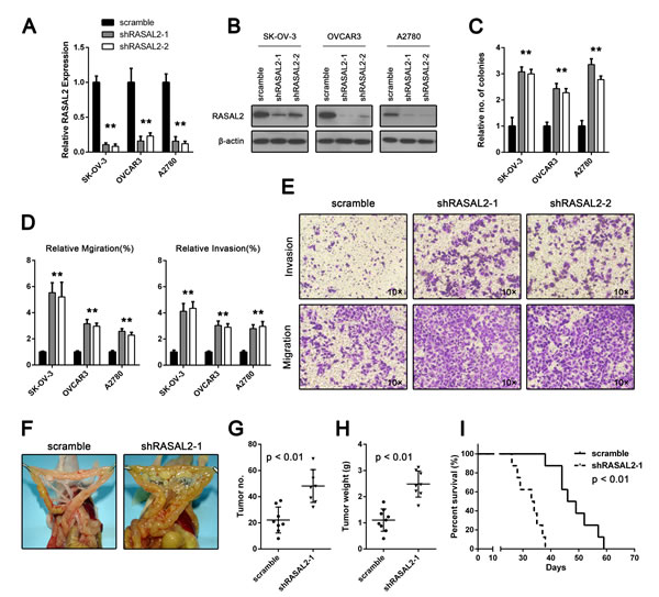 RASAL2 regulates in vitro ovarian cancer cell invasion and anchorage-independent growth and in vivo tumor formation.