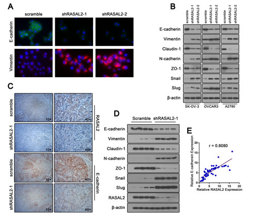 RASAL2 regulates EMT in ovarian cancer.