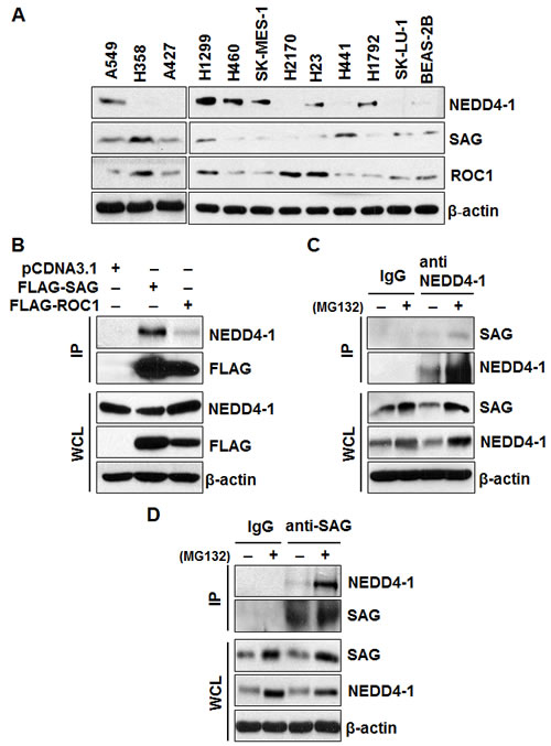 Levels of SAG and NEDD4-1 in lung cancer cells and SAG-NEDD4-1 binding.