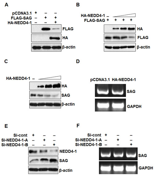 NEDD4-1 negatively regulates SAG protein level.