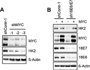 HK2 levels in HeLa cells depend on E6/E7-linked stimulation of MYC expression.