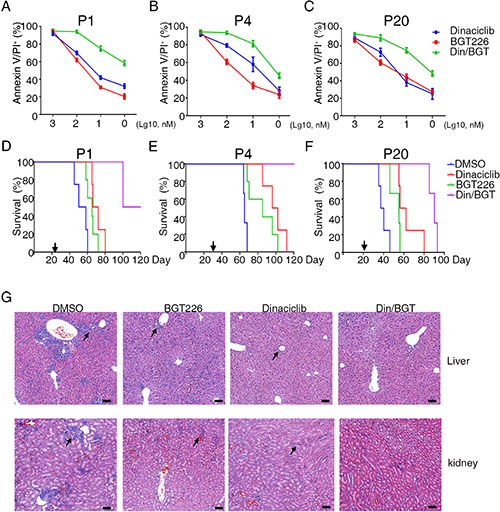 Dinaciclib and BGT226 induce the apoptosis of primary B-ALL cell in vitro and increase survival of xenografts.