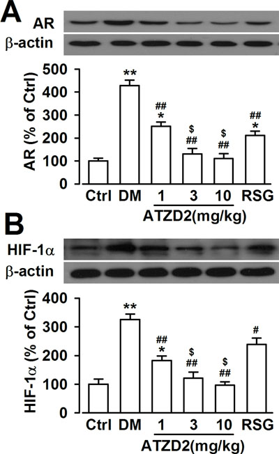Effects of ATZD2 on aldose reductase (AR) and hypoxia induced factor 1&#x03B1; (HIF-1&#x03B1;) in T2DM rats.