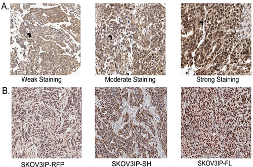 SKOV3IP xenograft tumors recapitulate the expression of ARID3B in ovarian cancer.