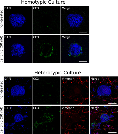 Cancer-associated fibroblasts alter drug responses in vitro.