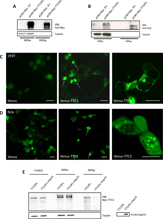 Overexpression of TTC3 forms aggregate structures in cells.