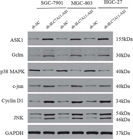 The protein of cyclin D1, ASK1, Gclm, p38, c-Jun and JNK were changed after knocking down SLC7A11-AS1 with specific shRNA or negative control shRNA.