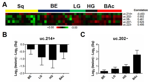 T-UCR expression is altered in the carcinogenic progression from squamous epithelium to Barrett&#x2019;s adenocarcinoma.