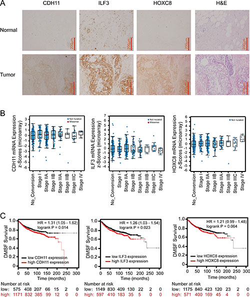 Immunohistochemistry of ILF3, CDH11 and HOXC8 in breast cancer specimens and analyses of ILF3, CDH11 and HOXC8 expression using publicly available datasets.