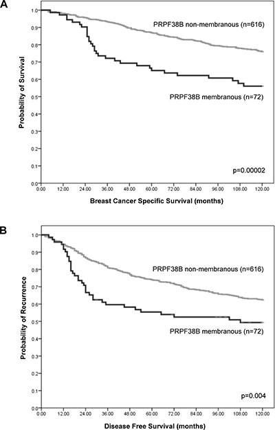 Relationship between cellular PRPF38B expression and survival of patients with breast cancer.