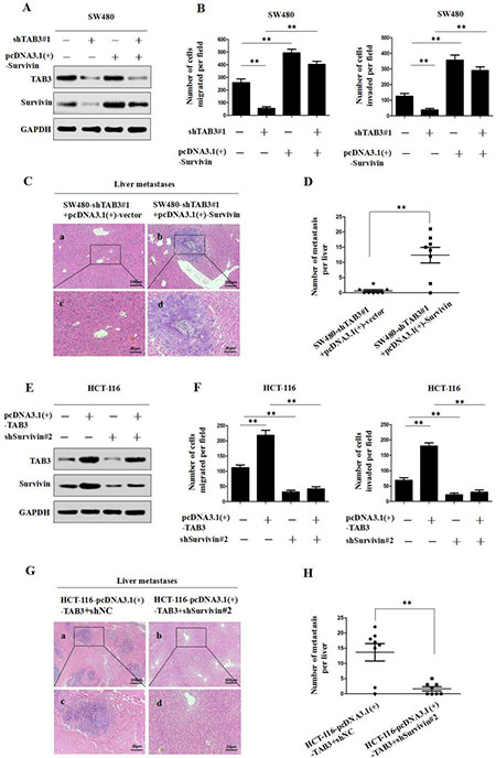 TAB3 promotes CRC invasion and metastasis by upregulating Survivin expression.