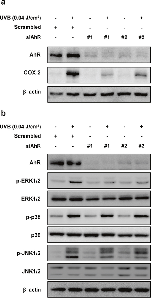 Effect of AhR knockdown on UVB-induced COX-2 expression and phosphorylation of ERK1/2, p38, and JNK1/2 in HaCaT cells.