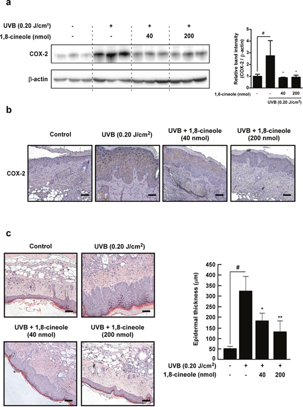 Effect of 1,8-cineole on UVB-induced COX-2 expression and epidermal hyperplasia in SKH-1 hairless mouse skin.