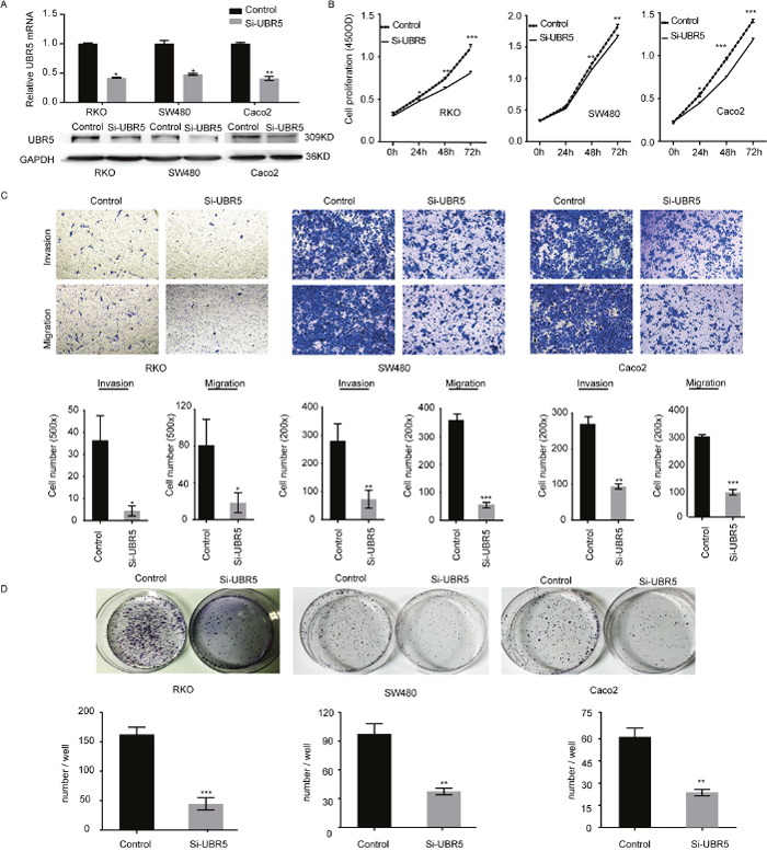 UBR5 promotes the growth and aggressiveness of CRC cells.