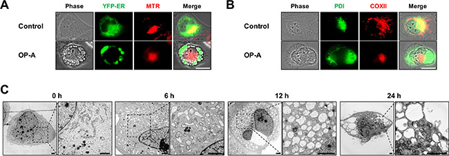 OP-A induces paraptosis-like cell death in various glioma cells.