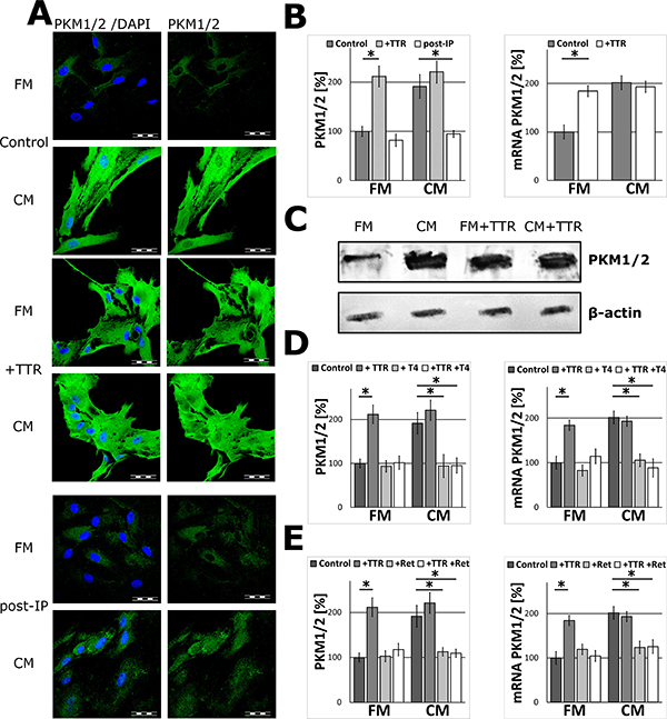 The effect of TTR on PKM1/2 expression in astrocytes.