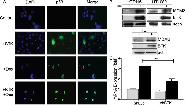 Effects of BTK on MDM2 expression.