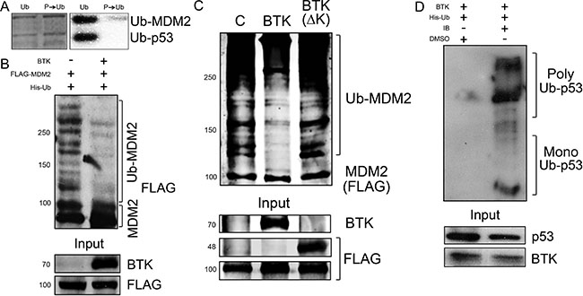 BTK inhibits MDM2 ubiquitination activity.