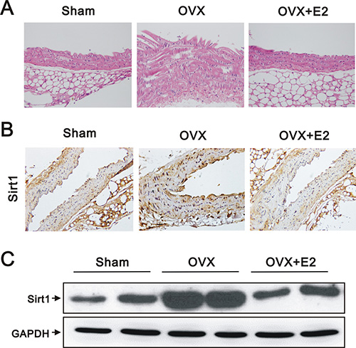 Histology, IHC, and western blot analyses of aortas from sham, OVX, and OVX+E2 mice.
