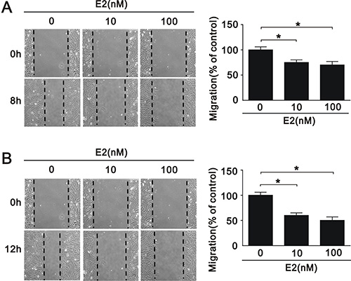 Migration of A7r5 cell treated with E2.