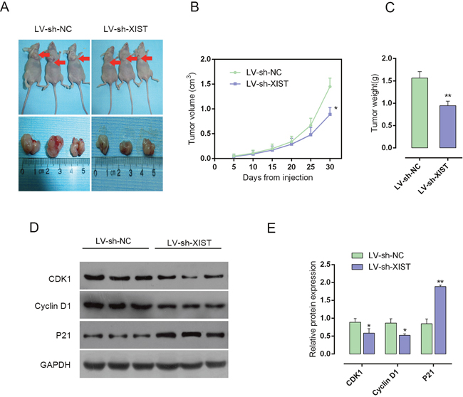 Knockdown of XIST reduces tumor volume in nude mouse xenograft model.