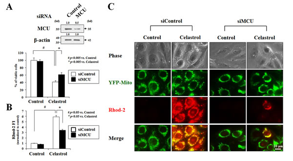 MCU knockdown inhibits celastrol-induced paraptosis.