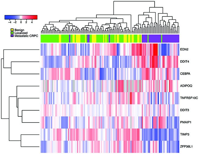 Expression of nominated siRNA hits in CRPC tumors, primary tumors, and benign prostate samples.