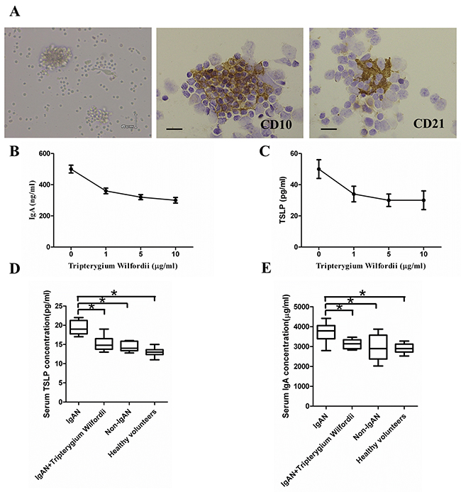 Thymic stromal lymphopoietin (TSLP) enhanced IgA production in follicular dendritic cell (FDC)-associated clusters through TSLP receptor (TSLPR), and serum IgA and TSLP concentrations.