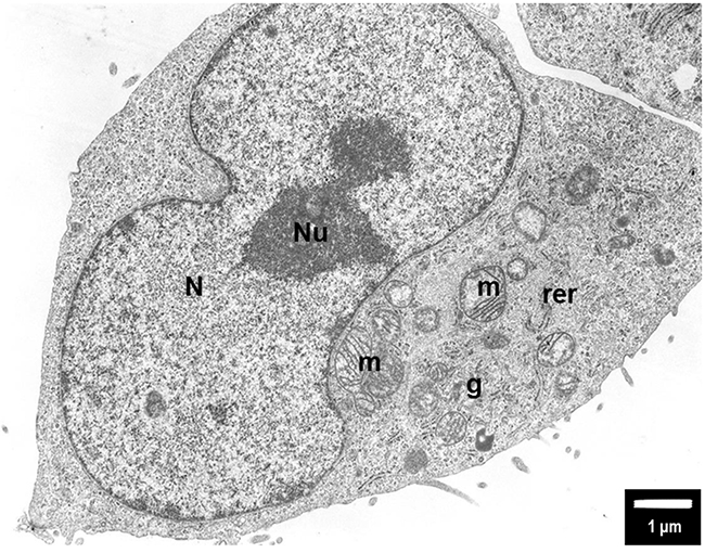The untreated (control) PANC-1 cells shows normal morphology with euchromatic nucleus (N) and nucleolus (Nu), round mitochondria (m) with well-organized cristae and electron-lucent matrix.