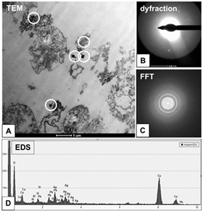 Characterization of 2.6 nm AgNPs in PANC-1 cells.