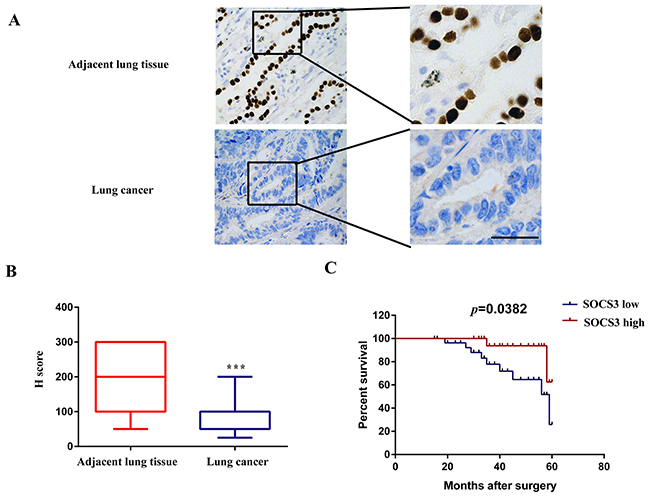 SOCS3 is significantly down-regulated in NSCLC tissues and is correlated with poor clinical outcomes.