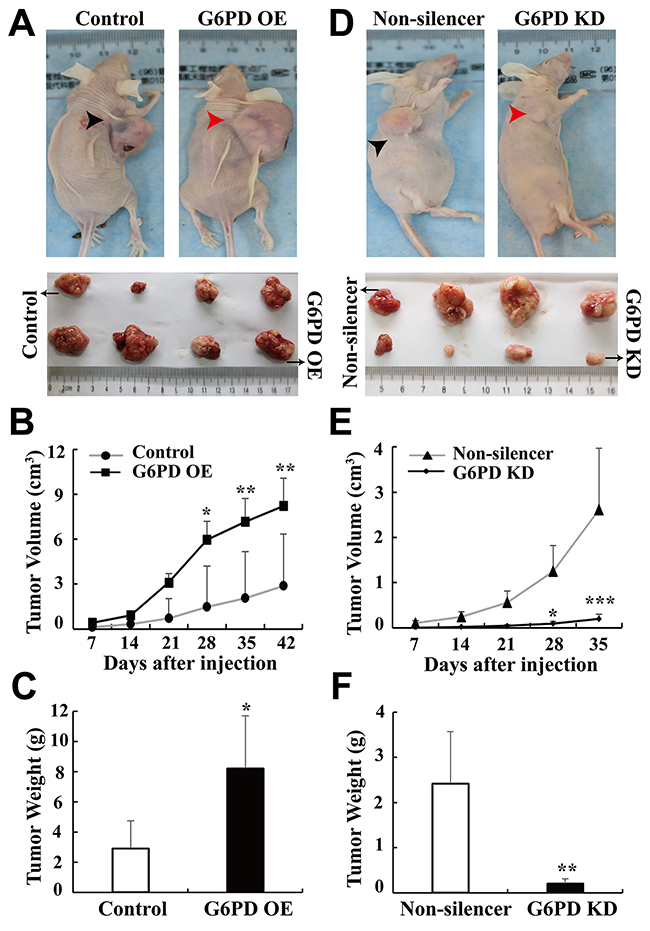 G6PD promotes xenografted RCC development in vivo.