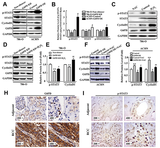 p-STAT3 is increased by G6PD-facilitated ROS accumulation in RCC.