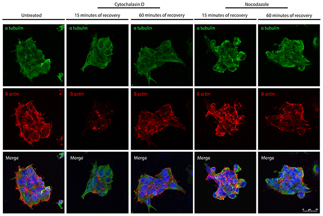 Confocal microscope images showing re-polymerization of microtubules (&#x03B1;-tubulin in green) and actin filaments (B-actin in red) after cythochalasin D or Nocodazole treatment in iPSCs.