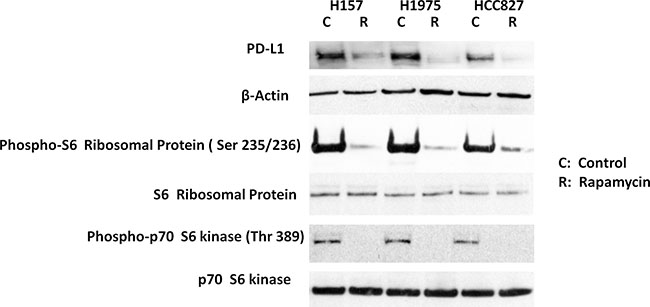 Exposure to the mTOR inhibitor rapamycin reduced PD-L1 expression in non-small cell lung cancer cell lines.