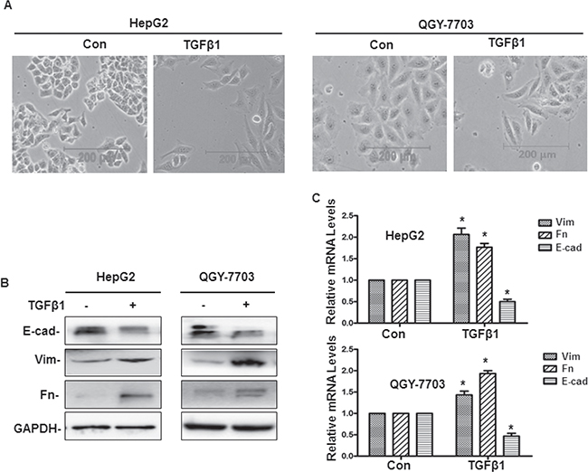 TGF-&#x03B2;1-induced EMT in hepatoma cells.