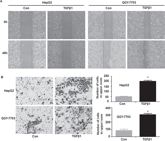 TGF-&#x03B2;1-induced invasion and metastasis in hepatoma cells.